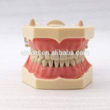 32 pcs dents amovibles SF Type modèle d&#39;étude dentaire pour l&#39;éducation scolaire 13009